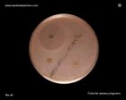Listeria monocytogenes susceptibility
